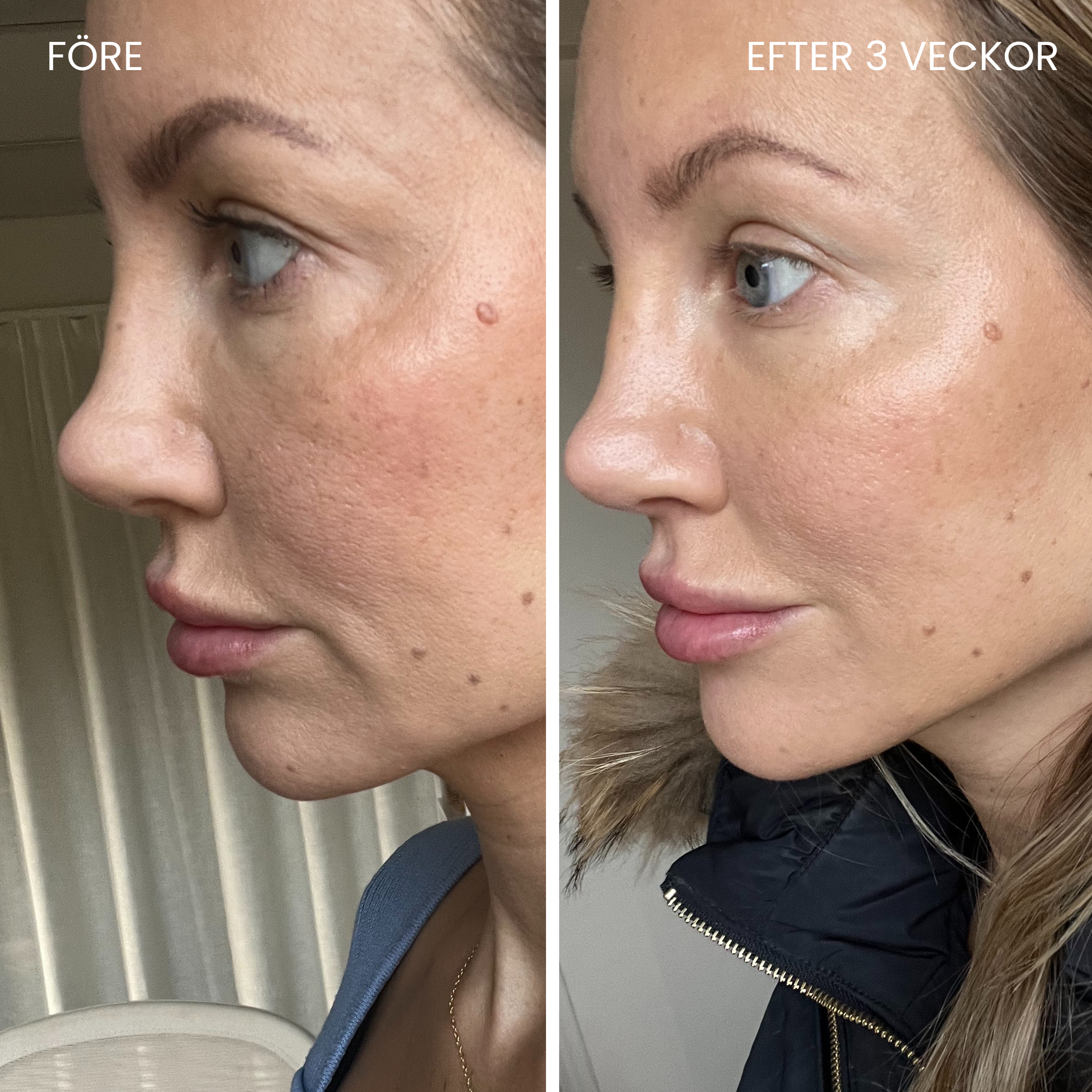 Skinboosting LED-maske