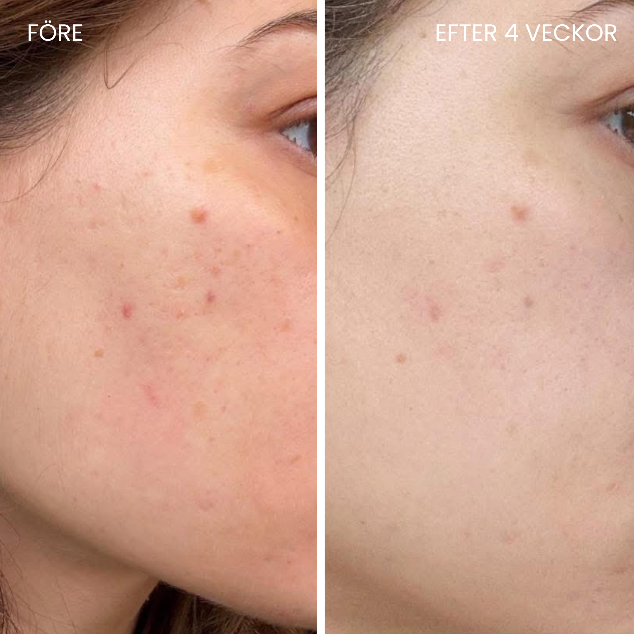 Skinboosting LED-maske