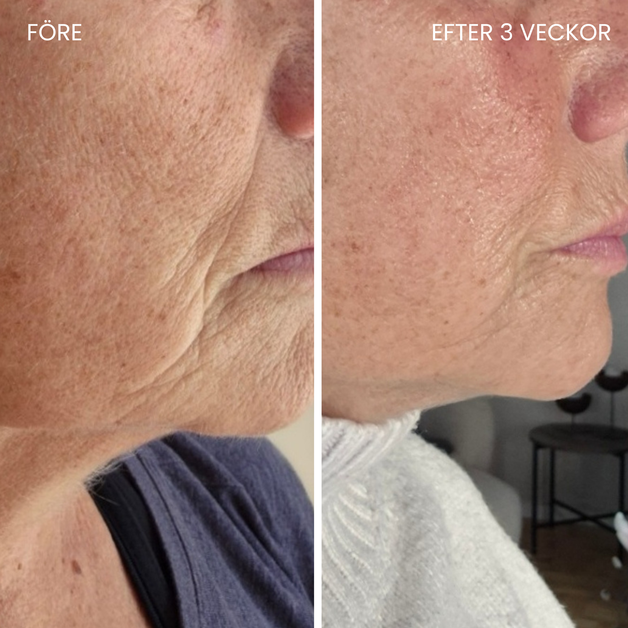 Skinboosting LED-maske