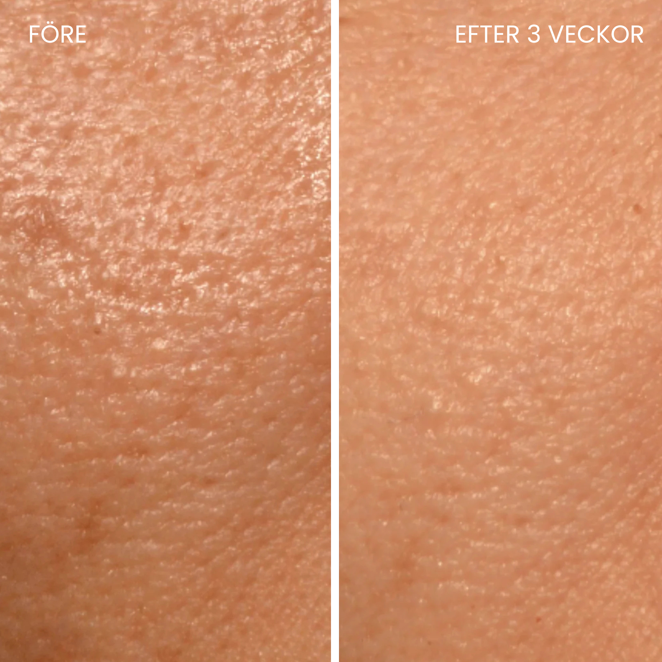 Skinboosting LED-maske