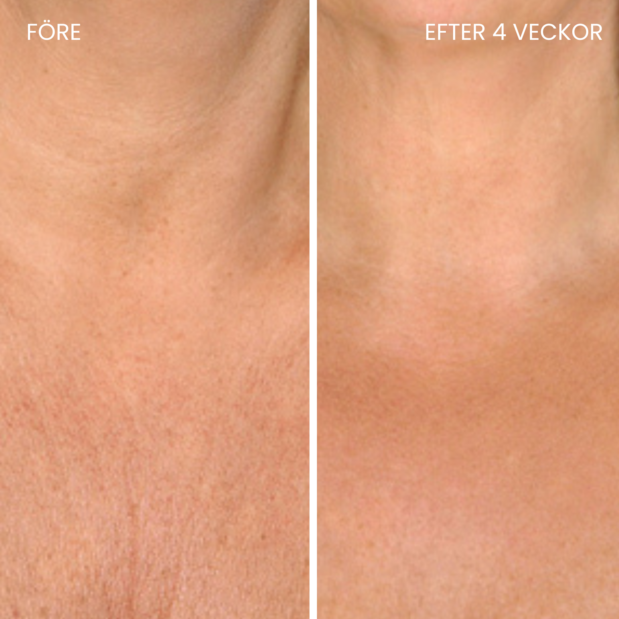 Skinboostende LED-halsbånd