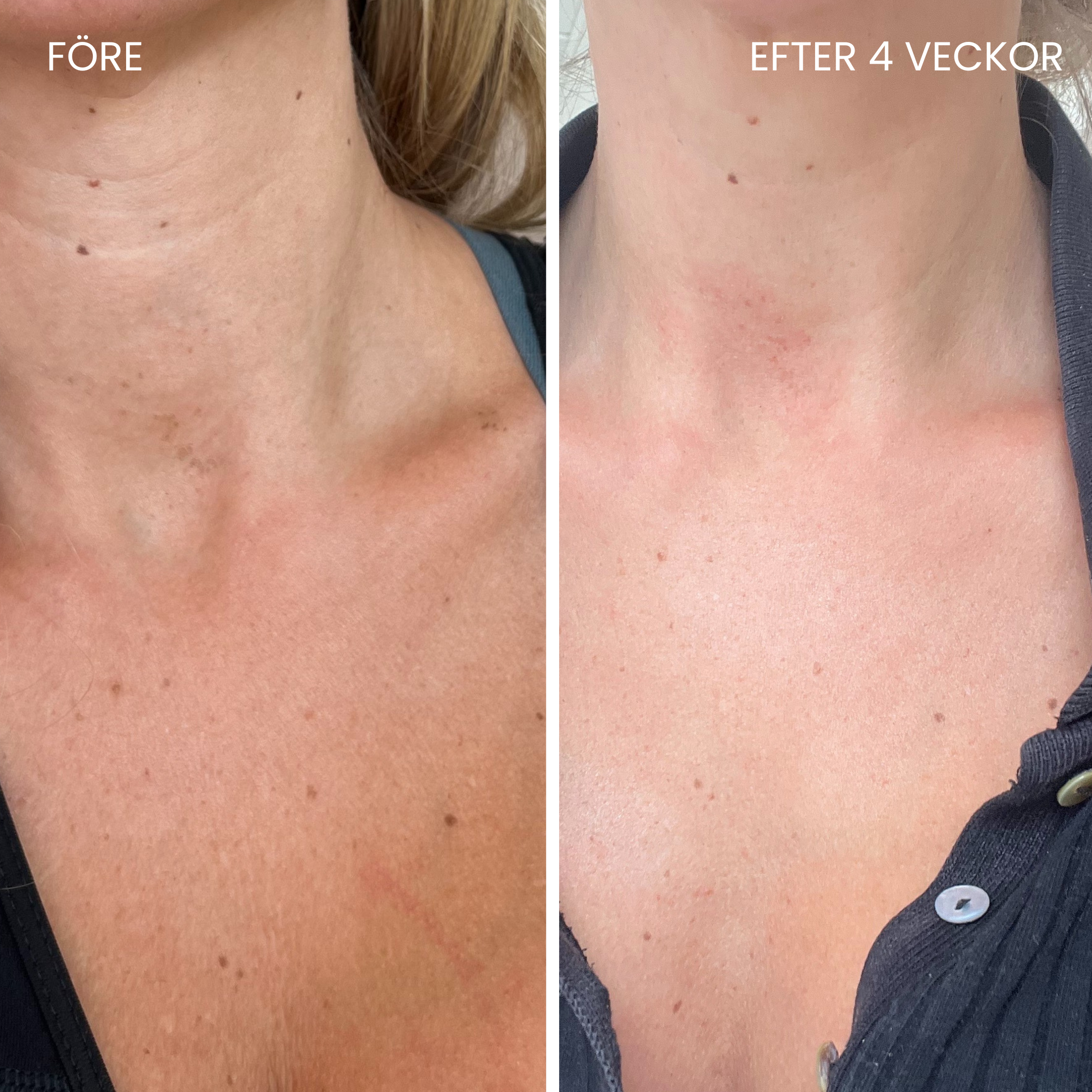 Skinboostende LED-halsbånd