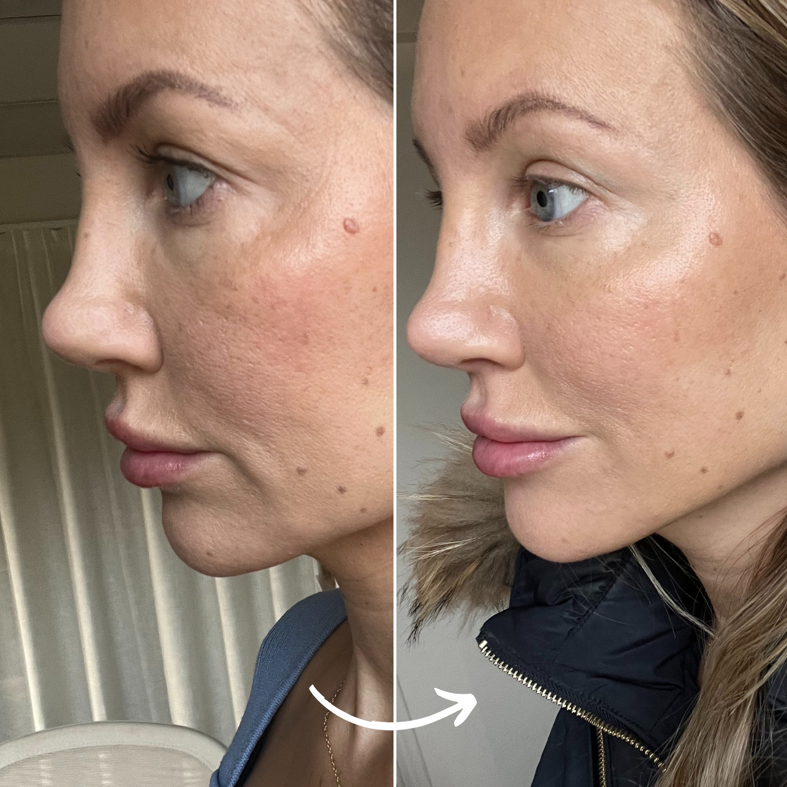 SCANDIFACE Skinboosting LED-maske