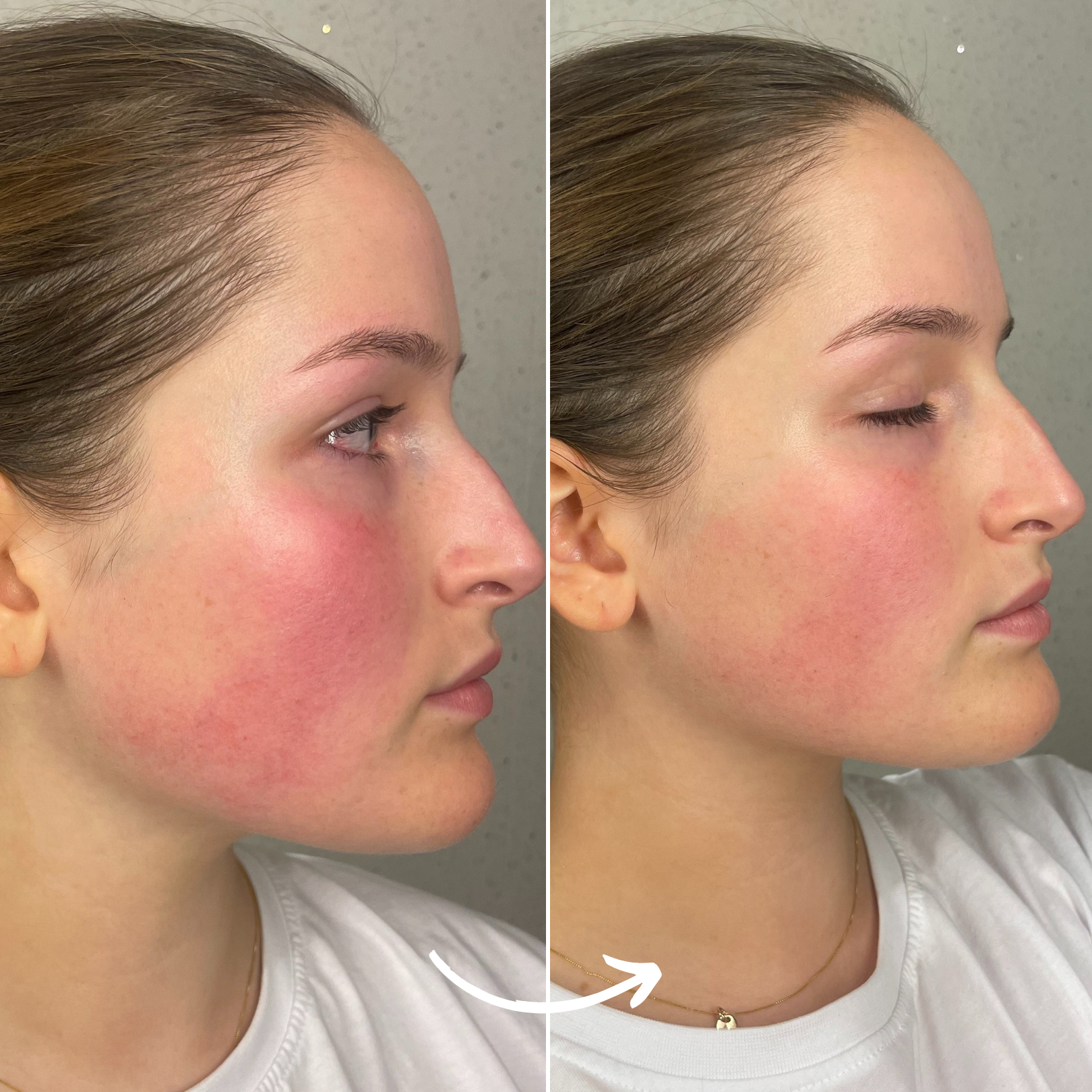 SCANDIFACE Skinboosting LED-maske