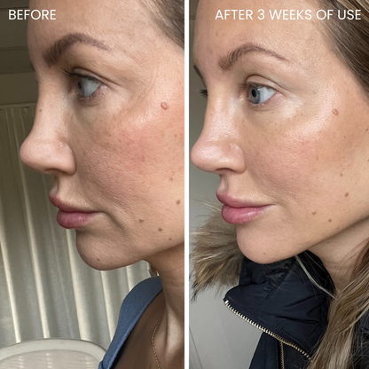 Skinboosting LED-maske